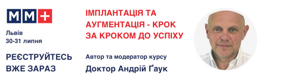 Імплантація та аугментація — крок за кроком до успіху