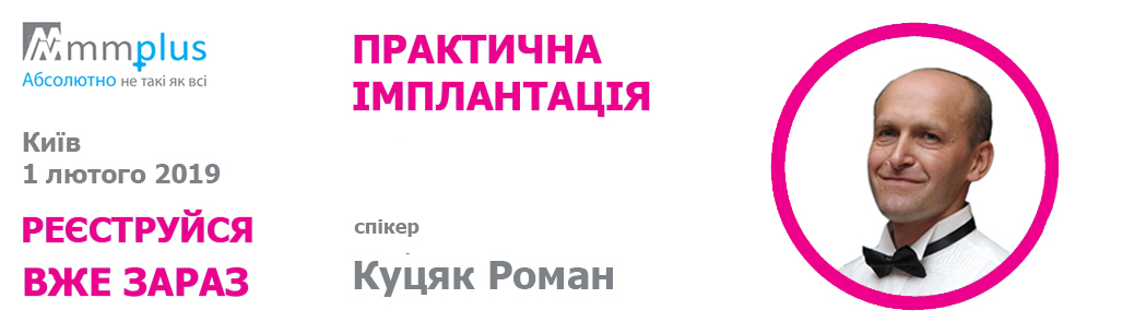 ПРАКТИЧНА ІМПЛАНТАЦІЯ