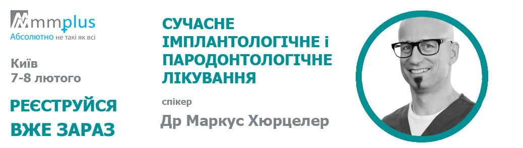 Сучасне імплантологічне і пародонтологічне лікування