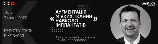 Аугментація м’яких тканин навколо імплантатів